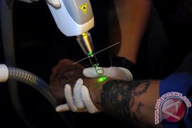 Program Penghapusan Tato