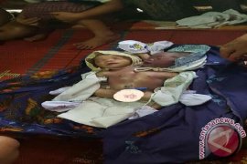  Bayi Kembar Siam Berkepala Dua Itu Meninggal