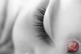 "Putri Tidur" Akhirnya Membuka Mata