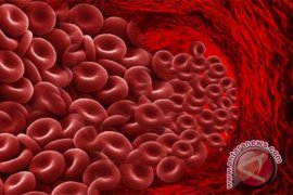 Peneliti IPB: Pengaruh Suplementasi Besi terhadap Hemoglobin Remaja Putri