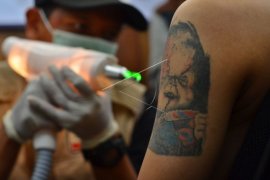Program pelayanan hapus tato gratis