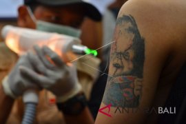 Layanan Hapus Tato Gratis