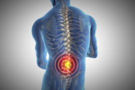 Pertolongan pertama untuk sakit pinggang