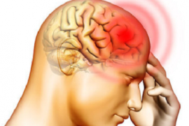 Berikut cara agar terhindar dari migrain saat cuaca panas