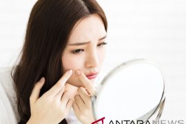 Dua Faktor Pemicu Timbulnya Jerawat