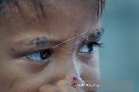 Anak-anak Pengungsi Petobo Jalani Pemulihan Psikologis