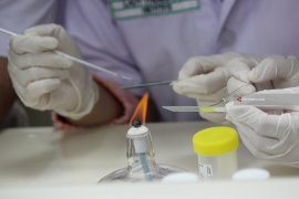 News Focus-- Indonesia committed to simultaneously handling TB and COVID-19