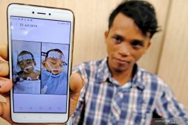 Tim dokter berhasil pisahkan bayi kembar siam (video)