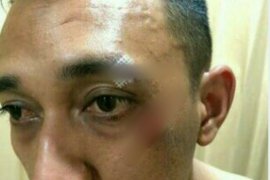 Bandar narkoba yang mengeroyok Kapolsek Patumbak tewas tertembak