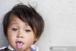 Balita Bermata Biru Di Bandung