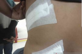 Satu orang tewas akibat tawuran antarpelajar