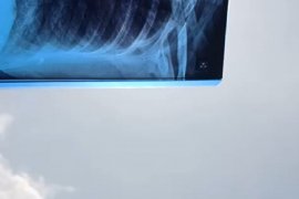 Cara unik warga Sambas lihat gerhana matahari