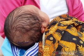 Miris, kepala bayi di Inhil putus dan tertinggal di rahim saat dilahirkan