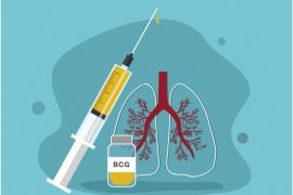 Brazil uji keampuhan vaksin BCG untuk pengobatan COVID-19