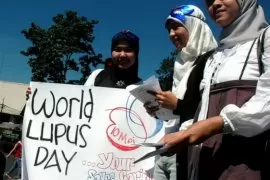 Dokter:  Galakkan edukasi guna cegah komplikasi pada penderita lupus