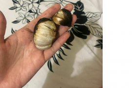 Melalui akun instragram pribadi, pasien COVID-19 mengaku sembuh usai konsumsi bawang putih