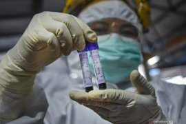 Rapid Test Biozek Covid-19 IgG/IgM dibuat di Belanda