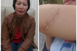 Tiga korban penjambretan di Langkat berharap pelaku dihukum seberatnya