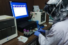 9.106 sampel uji COVID-19 telah diperiksa di Lab RSWS Makassar