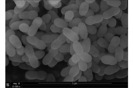 Five of Kirin’s proprietary Lactococcus lactis strain Plasma products registered as “Foods with Function Claims”