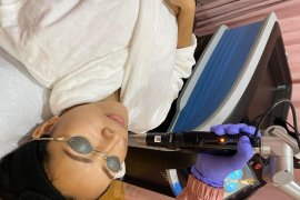 Perawatan kulit dengan teknologi pikosekon