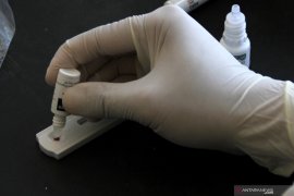 Kemenkes tegaskan rapid test tetap berlaku bagi pelaku perjalanan