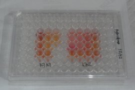 Dosen IPB kembangkan alat diagnosis Alzheimer