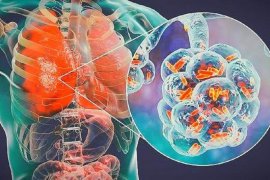 Dokter sebut  penderita jantung paling berisiko jika terpapar COVID-19