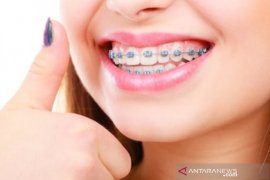 Bahayakah menggunakan behel  terlalu lama?