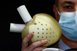 Pria Australia hidup 105 hari dengan jantung titanium sebelum transplantasi