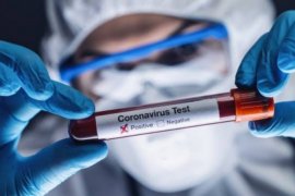 17 anggota dewan dan 151 anggota staf terinfeksi virus corona