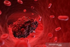 Italia laporkan empat kematian pembekuan darah usai divaksin AstraZeneca