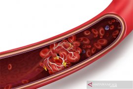 Italia laporkan empat meninggal akibat pembekuan darah vaksin AstraZeneca