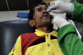 Tak punya uang dan ditraktir makan, penumpang ini justru aniaya tukang ojek di Inhil