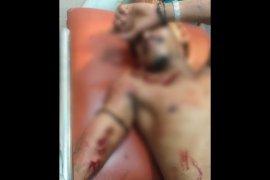 Niat lerai penganiayaan di pasar, pria di Dompu ini malah kena bacok