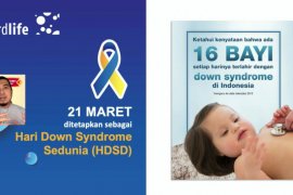 Peringati HDSD, Cordlife  gelar "Down Syndrome Got Talent"