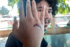 Cari makan sahur, editor Detikcom Surabaya jadi korban begal