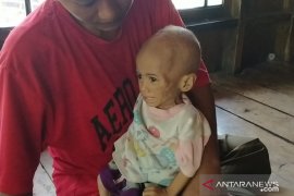 Program kader posyandu di Cianjur ditingkatkan untuk tekan gizi buruk