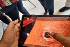 Enam warga Tulungagung terpapar antraks berangsur sembuh