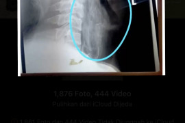 Ikan Papuyu tersangkut pada tenggorokan pemancing di Balangan