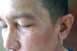 Anggotanya dipukuli saat meliput, Ketua PWI Dumai dampingi korban lapor polisi