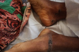 Warga Desa Telagah Jernih Secanggang kesetrum listrik tegangan tinggi meninggal