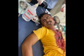 Gara-gara ibunya dimarahi, seorang pemuda di Sumbawa Barat bacok tetangganya