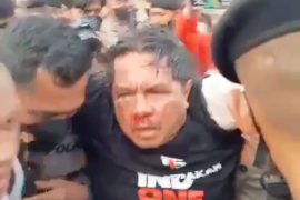 Ade Armando  babak belur dianiaya massa saat demo depan gedung DPR