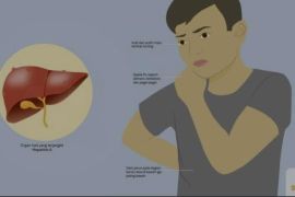 Hepatitis Akut tak berkaitan vaksinasi COVID-19