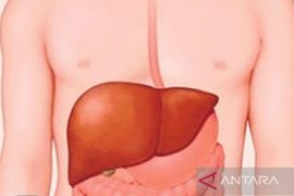 Dinkes Babel temukan kasus Hepatitis B bukan akut