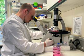 Kasus cacar monyet di Spanyol jadi 84 kasus