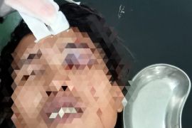 Cekcok di kedai tuak, pria di Rohil tusuk mata temannya