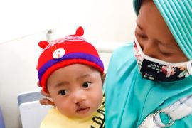 Ibu hamil terpapar zat kimia berbahaya bisa sebabkan anak bibir sumbing