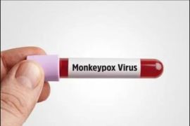 Argentina umumkan kematian pertama akibat cacar monyet